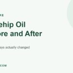 Rosehip oil before and after: what 30 days actually changed